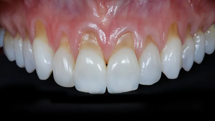 Periodontia